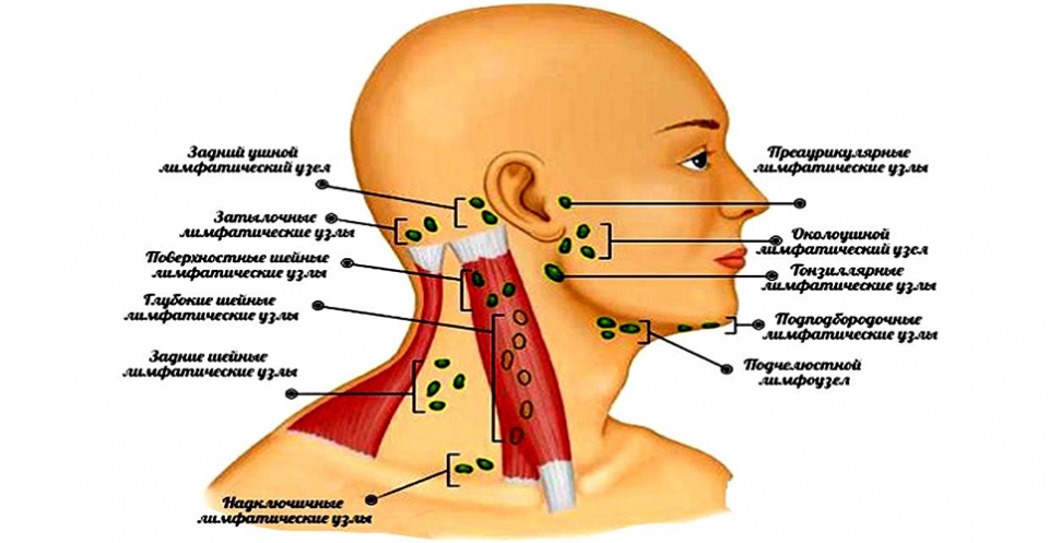 Увеличенные лимфоузлы на шее: причины, последствия и что делать